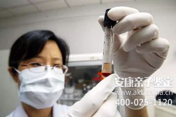 北京上海亲子鉴定样本采集大全,做亲子鉴定口腔细胞怎么采集？ 
